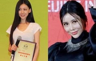 五个悔不该当初去整容的女星,郑爽上榜,网友 图5真的太可惜了
